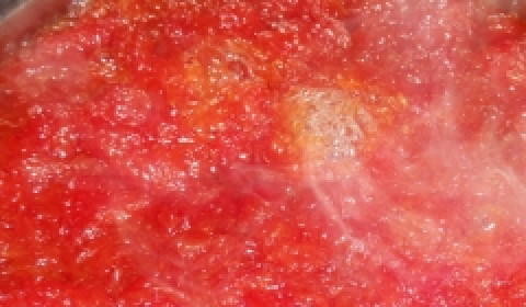 1. Этап. Варенье из грейпфрута: Варите на слабом огне около 2-х часов, в конце добавьте корицу.