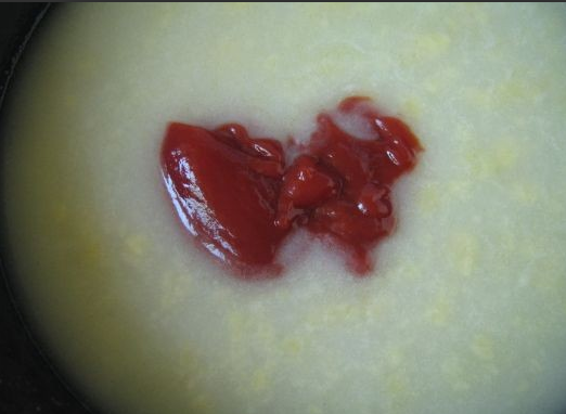 1. Этап. Сосиски в томатном соусе: 2. На растительном или сливочном масле обжарим муку. Затем добавим бульон из кастрюли, томатную пасту, специи. Тушим на маленьком огне, пока не загустеет.