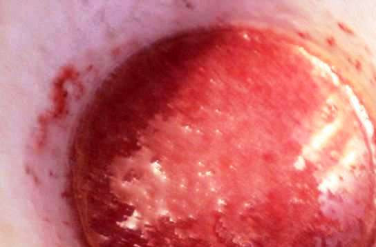 1. Этап. Клубничное суфле для торта: Смешайте желатин с клубничным пюре.